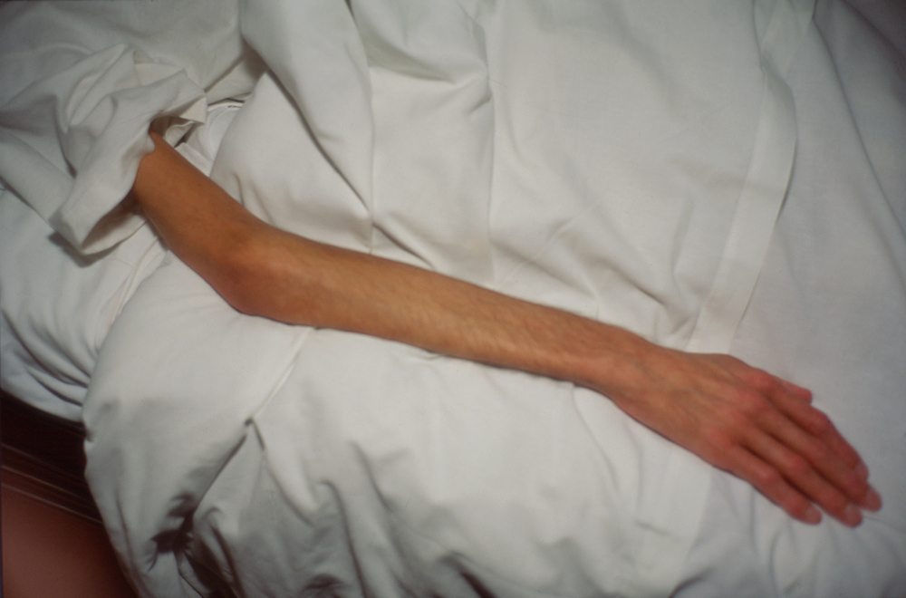 Nan Goldin, “Gilles’ Arm”, Paris (1993). Tirage cibachrome monté sur Sintra, 68,3 x 101,6 cm. Courtesy de l’artiste et Galerie Marian Goodman (Londres, New York, Paris)
